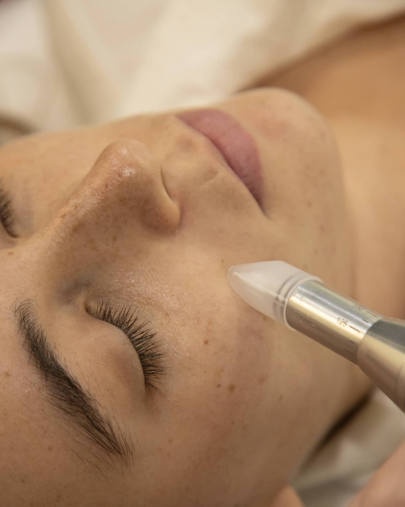 Nanopore tratamientos de medicina regenerativa encaminados a aumentar la producción de colágeno y elastina y el brillo natural de la piel